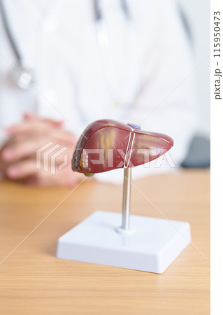 Doctor with human Liver anatomy model. Liver cancer and Tumor, Jaundice, Viral Hepatitis A, B, C, D, E, Cirrhosis, Failure, Enlarged, Hepatic Encephalopathy, Ascites Fluid in Belly and health concept Doctor with human Liver anatomy model. Liver cancer and Tumor, Jaundice, Viral Hepatitis A, B, C, D, E, Cirrhosis, Failure, Enlarged, Hepatic Encephalopathy, Ascites Fluid in Belly and health concept 115950473