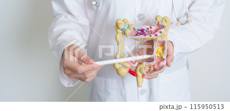 Doctor holding human Colon anatomy model. Colonic disease, Large Intestine, Colorectal cancer, Ulcerative colitis, Diverticulitis, Irritable bowel syndrome, Digestive system and Health concept 115950513