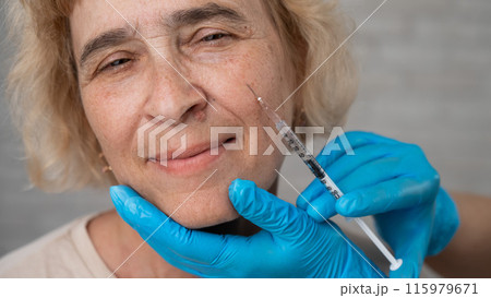 Doctor makes beauty injections in the face of an old caucasian woman. Doctor makes beauty injections in the face of an old caucasian woman. 115979671