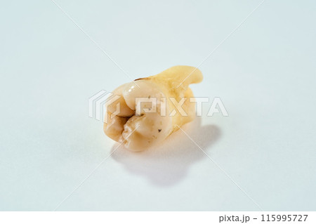 抜歯された歯と白背景 抜歯された歯と白背景 115995727