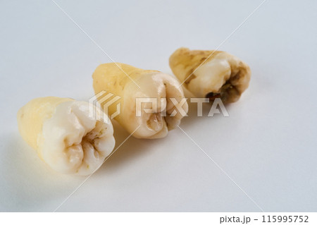 抜歯された歯と白背景 115995752