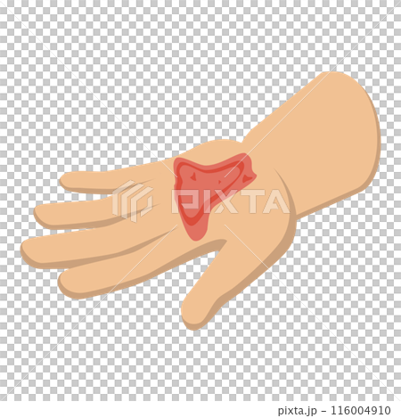 3D Isometric Flat Illustration of First Aid For Trauma. Item 7 3D Isometric Flat Illustration of First Aid For Trauma. Item 7 116004910
