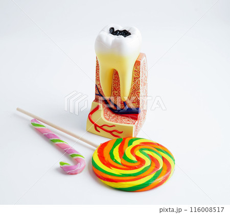 Tooth decay with sweet sugar candy, bad food for dental health care. 116008517