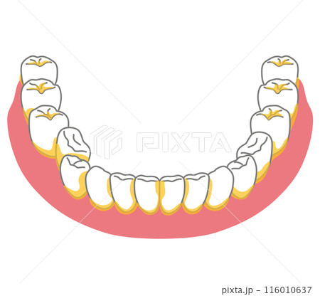 歯垢が残りやすいところ　歯磨き　磨き残し 116010637
