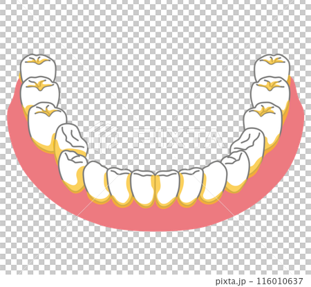 歯垢が残りやすいところ　歯磨き　磨き残し 116010637