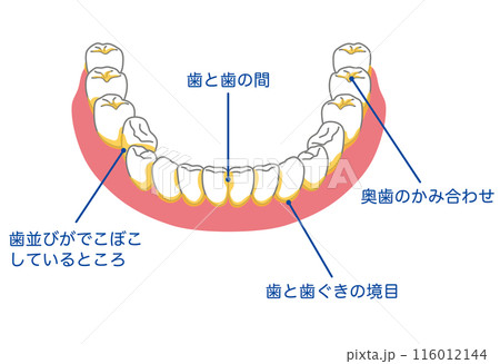 歯垢が残りやすいところ　歯磨き　磨き残し 116012144