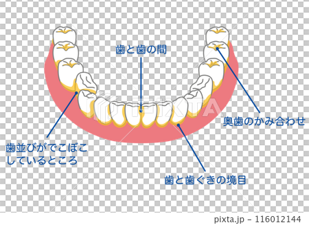 歯垢が残りやすいところ　歯磨き　磨き残し 116012144