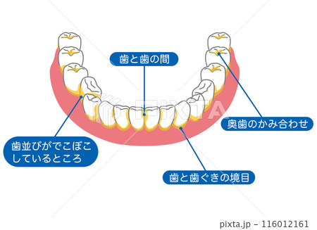 歯垢が残りやすいところ　歯磨き　磨き残し 116012161