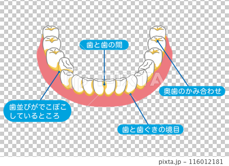 歯垢が残りやすいところ 歯磨き 磨き残し 歯垢が残りやすいところ 歯磨き 磨き残し 116012181