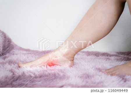 Foot plantar fasciitis and plantar inflammation Foot plantar fasciitis and plantar inflammation 116049449