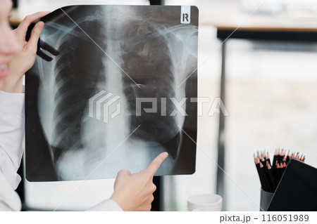 Close-up of a medical professional pointing at a chest X-ray image, highlighting diagnostic details in a modern clinic environment. 116051989