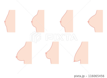 乳房の形　種類 116065456