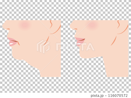 Sagging chin 116070572