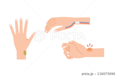 女性の更年期障害：ドケルバン病のイメージイラストセット 116073098