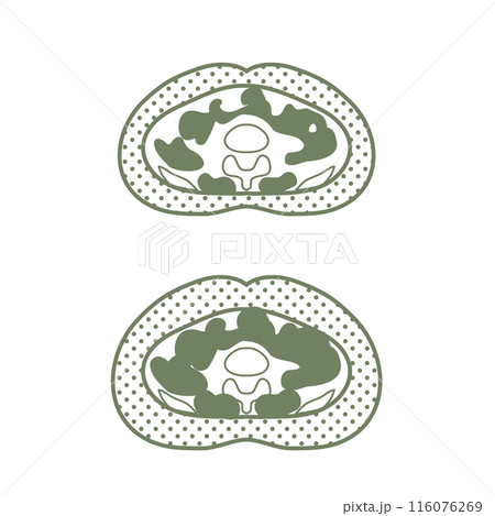 おなかの断面図 116076269