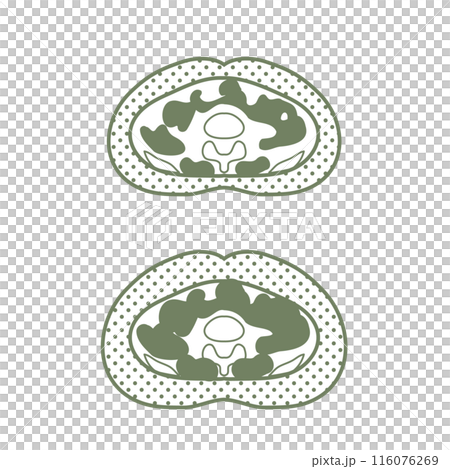 おなかの断面図 116076269