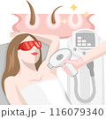 Cosmetologist removes unwanted hair from underarm area body of a girl with a help of laser epilation procedure 116079340