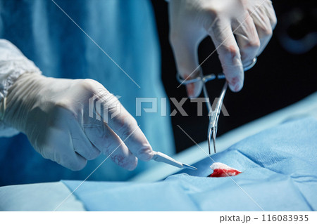 Detail shot of unrecognizable surgeon holding tools performing surgery in operating room copy space Detail shot of unrecognizable surgeon holding tools performing surgery in operating room copy space 116083935