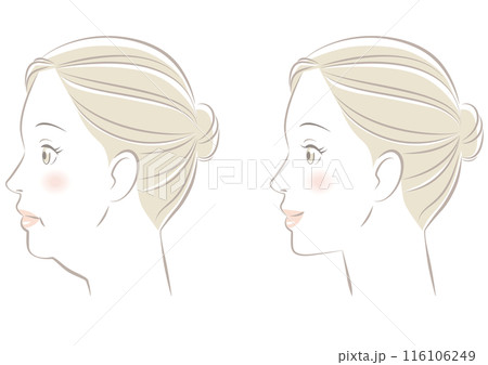 あごのたるみ 116106249