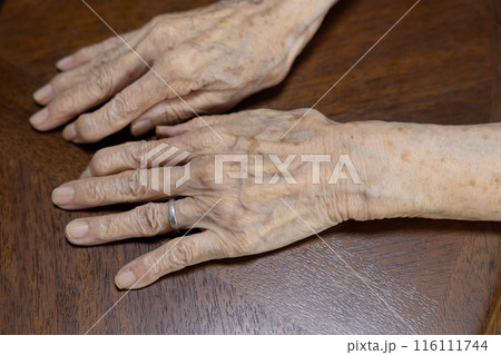 年を取って指が曲がってきた高齢女性の手 年を取って指が曲がってきた高齢女性の手 116111744