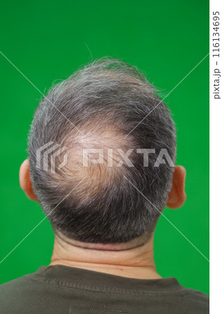 A man with thinning hair is standing with his back to the viewer, set against a green background A man with thinning hair is standing with his back to the viewer, set against a green background 116134695