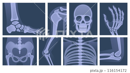 Human skeleton. X ray body parts skull bones of arms knee and legs exact vector medical picture scanning 116154172