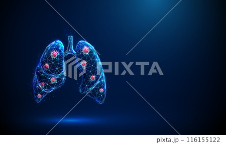 Abstract blue human lungs wih red viruses inside. Respiratory and viral lung diseases, healthcare protection medical concept. Low poly style. Geometric background Wireframe structure 3d graphic Vector Abstract blue human lungs wih red viruses inside. Respiratory and viral lung diseases, healthcare protection medical concept. Low poly style. Geometric background Wireframe structure 3d graphic Vector 116155122