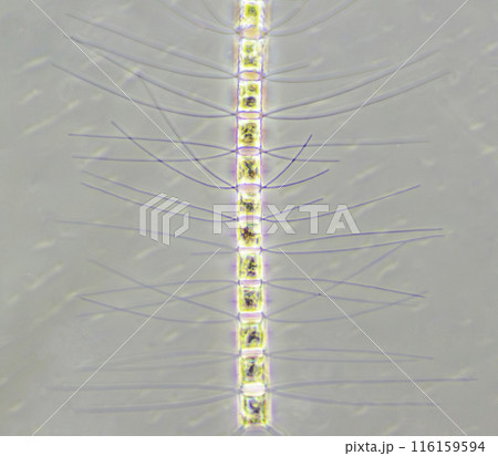 珪藻　ツノケイソウ 116159594