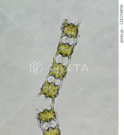 珪藻　レンダコケイソウ 116159656