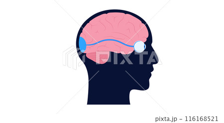 Optic nerve anatomy Optic nerve anatomy 116168521