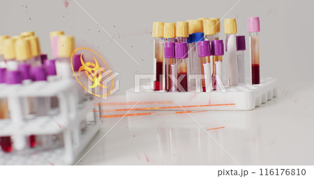 Image of emergency text over vials with liquid 116176810