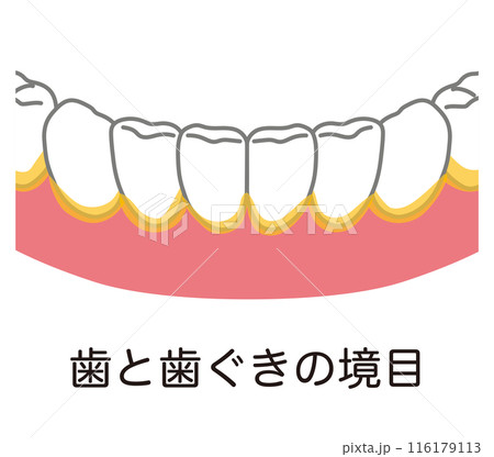 歯と歯ぐきの境目に溜まった歯垢　歯磨き　磨き残し 116179113