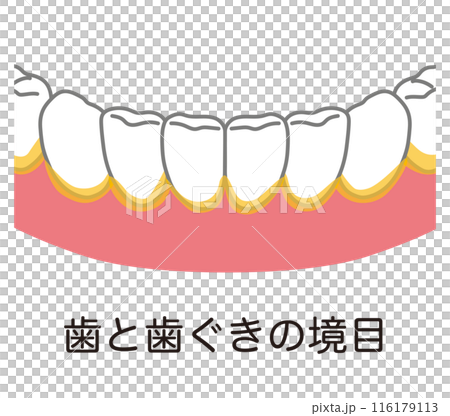 牙菌斑積聚在牙齒和牙齦之間的邊界處，是刷牙時殘留的 116179113