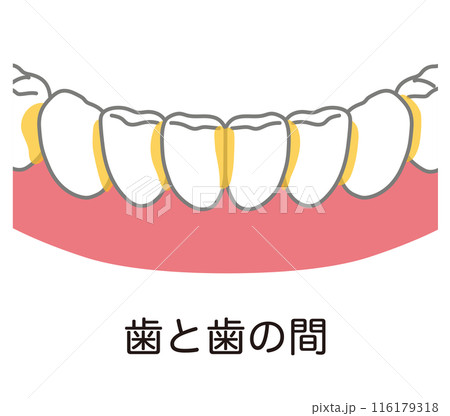 歯と歯の間に溜まった歯垢 歯磨き 磨き残し 歯と歯の間に溜まった歯垢 歯磨き 磨き残し 116179318