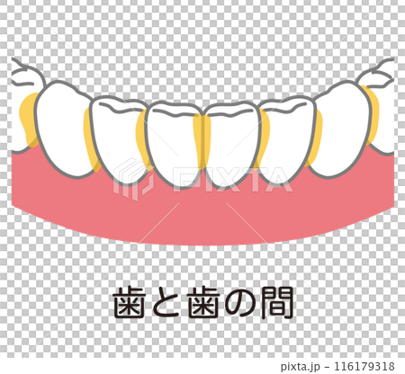 歯と歯の間に溜まった歯垢 歯磨き 磨き残し 歯と歯の間に溜まった歯垢 歯磨き 磨き残し 116179318