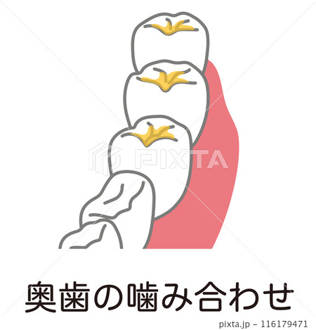 奥歯の噛み合わせに溜まった歯垢　歯磨き　磨き残し 116179471