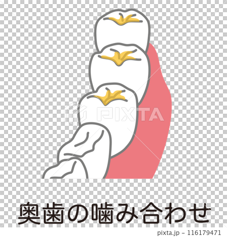 奥歯の噛み合わせに溜まった歯垢　歯磨き　磨き残し 116179471
