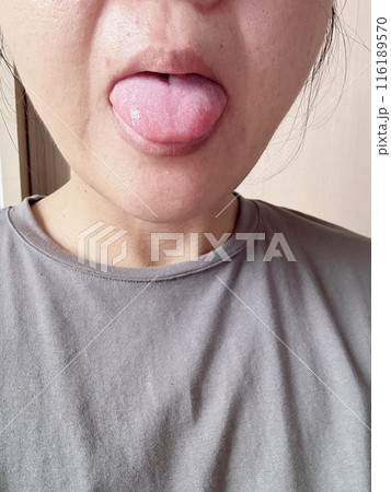 舌のケア 116189570