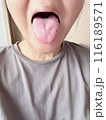 舌のケア 116189571