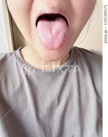 舌のケア 116189571