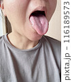 舌のケア 116189573