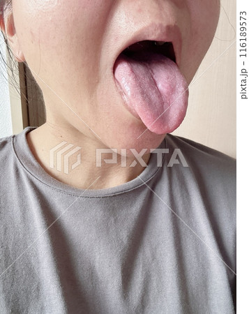 舌のケア 舌のケア 116189573