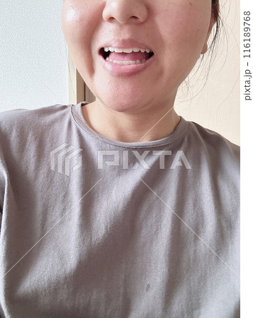 歯のホワイトニング 116189768