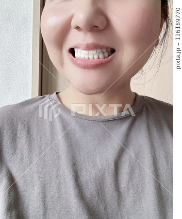 歯のホワイトニング 116189770