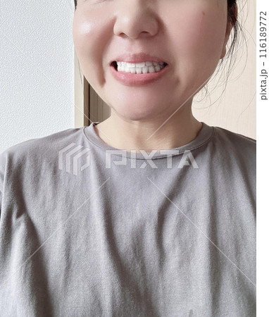 歯のホワイトニング 歯のホワイトニング 116189772