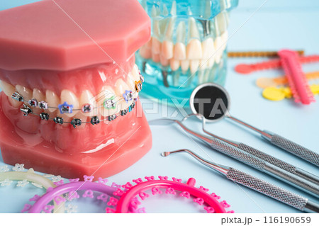 Orthodontic ligatures rings and ties, elastic rubber bands on orthodontic braces, model for dentist studying about dentistry. 116190659