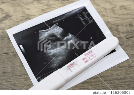 妊娠 エコー写真 妊娠検査薬 116206805