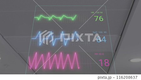 Image of heart rate monitor against view of roof at hospital Image of heart rate monitor against view of roof at hospital 116208637