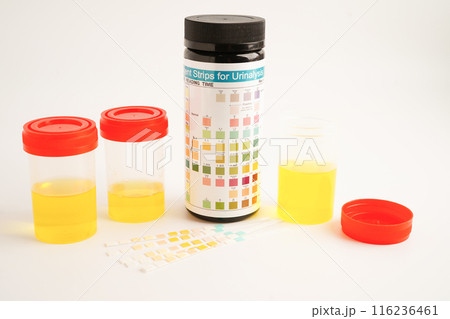 Urinalysis, urine cup with reagent strip pH paper test and comparison chart in laboratory. 116236461