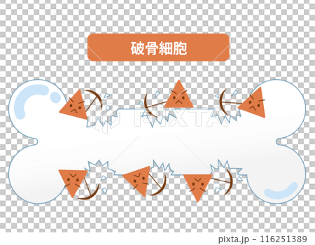 Mechanism of bone resorption by osteoclasts. Bone remodeling Mechanism of bone resorption by osteoclasts. Bone remodeling 116251389